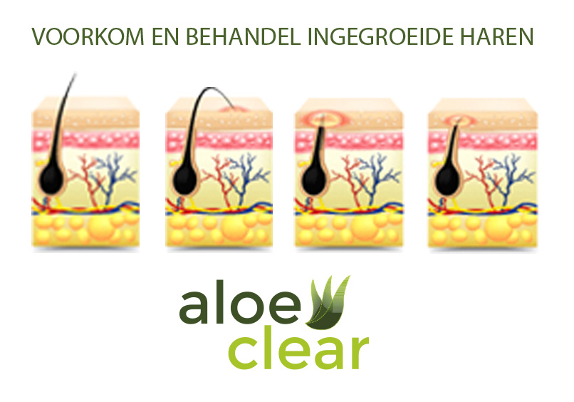 Voorkom-en-behandel-scheerirritatie-en-ingegroeide-haren
